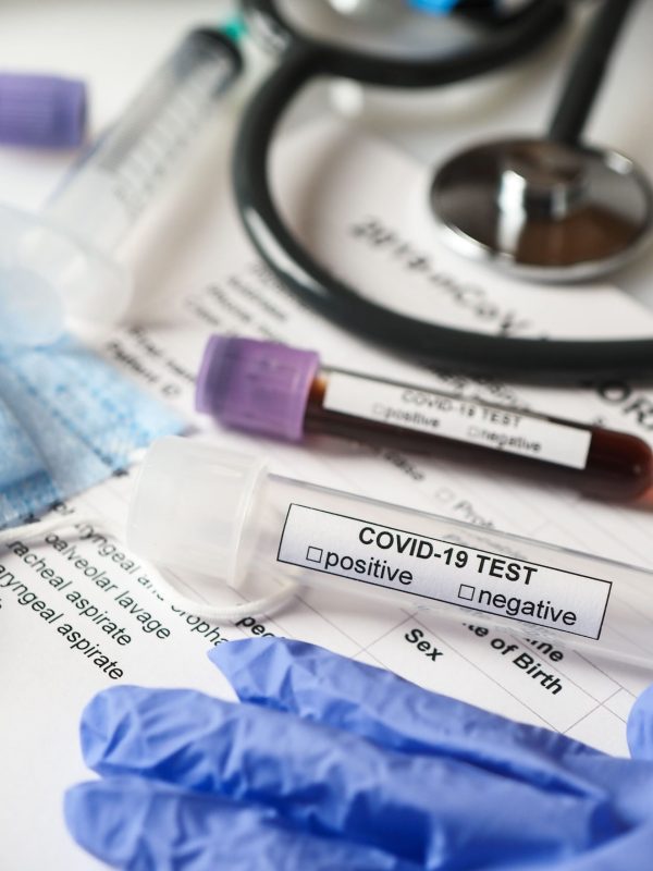 coronavirus-covid-2019-test-concept-2021-08-27-15-12-13-utc-min-scaled.jpg